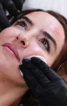 What to Know Before Considering Any Type of Plastic Surgery